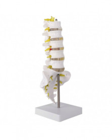 Modelo de columna lumbar...